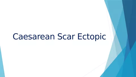 Title slide of the Caesarean Scar Ectopic training deck