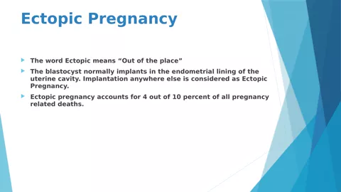 Definition slide from the training deck